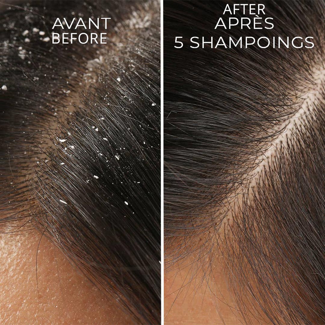 Propos'Nature Organic Anti - Dandruff Shampoo Api'Propolis - 200ml - Elliotti