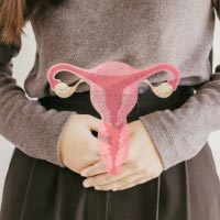 What is PCOS?